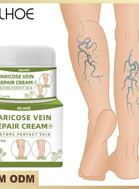 Varicose Veins Cream Varicose Vein Treatment Cream For Legs