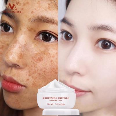 Anti Aging Face Cream Dark Spot Remover Freckle Whitening霜
