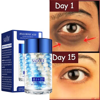 Hyaluronic Acid B5 eye cream Improve Dark Circle Wrinkle眼霜