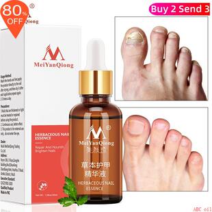 Fungal Nail Treatment Feet Care Essence Nail Foot Whitening