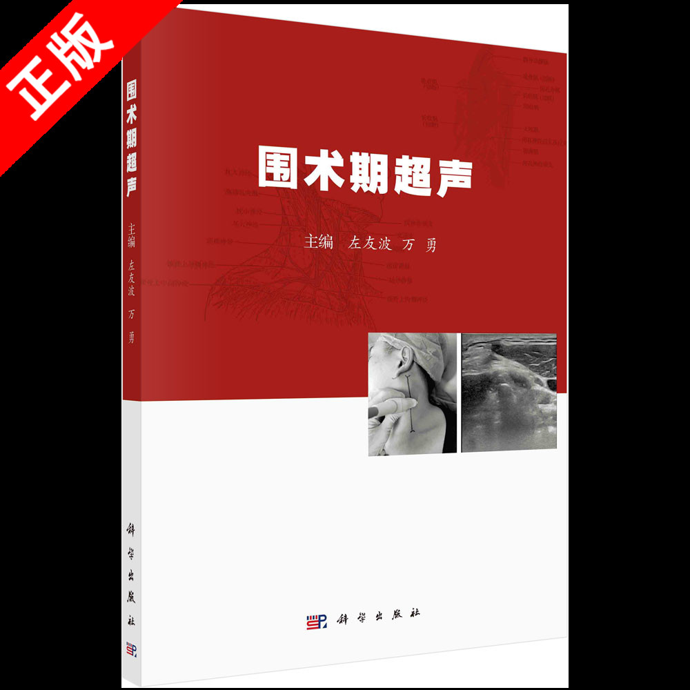 【书】正版围术期超声 围术期超声基础 超声引导的上肢神经阻滞 胃部超声在围术期的应用 左友波 万勇编著书籍KX