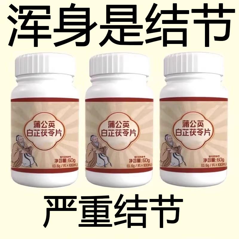 正品蒲公英白芷茯苓片消肿消结肿胀结节