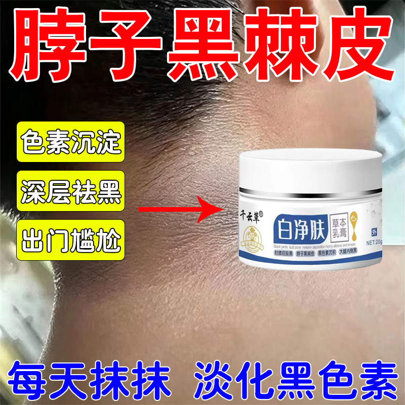 脖子洗黑不掉黑色素沉晒淀黑去色黑除素用黑皮棘大侧腿内修黑复用