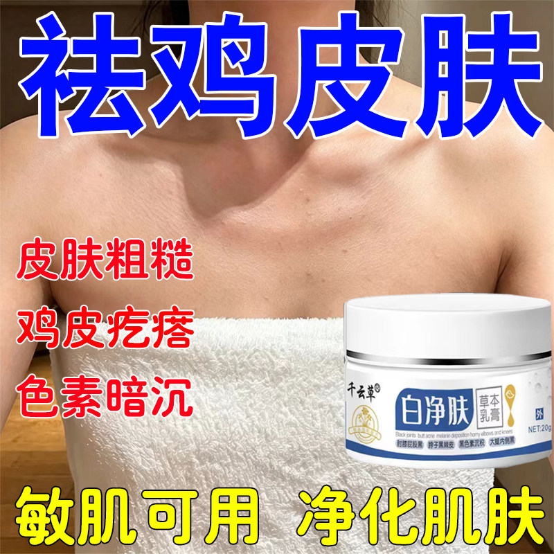 去鸡疙瘩皮毛角囊质皮粗糙肤小黑点全身可用鱼鳞肤淡化黑沉淀色素
