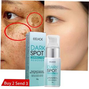 Nicotinamide Whitening Freckle Cream Dark Spot Remover Skin