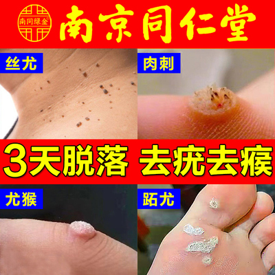 去除脖子脸部腋下足小肉粒脚疙瘩跖疣药膏扁平丝状尤一抹无忧神器