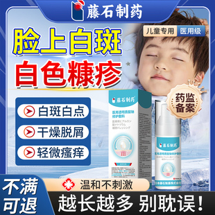 白色糠疹儿童脸上长白斑专用脸部长癣汗斑桃花癣瘙痒可搭膏药贴QN
