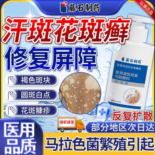 汗斑花斑癣沐浴露马拉色菌感染