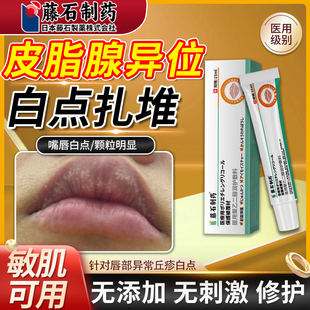 藤石制药嘴唇皮脂腺异位症白点丘疹脂肪小颗粒起泡干裂医用乳膏QN