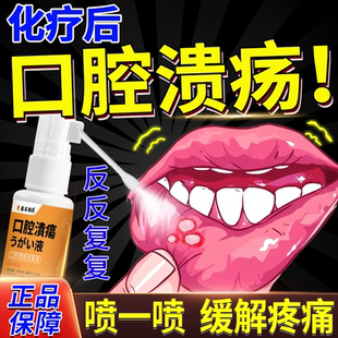 放化疗后口腔溃疡喷雾剂含漱液日本上火起泡根口疮治舌头烂白泡QN