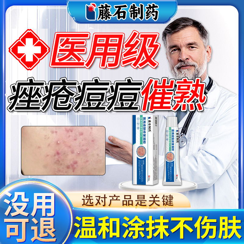 痘痘催熟膏淋巴痘腮边痘结节硬块痘下巴反复长痘内调药监备案QN