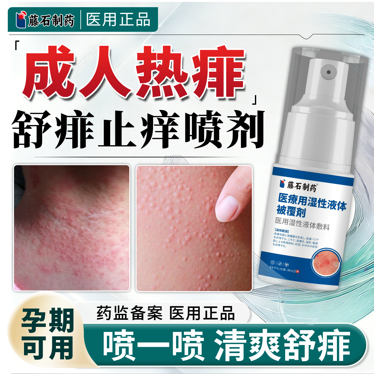 热痱水痱子搭止痒喷雾药膏去痱专成人大人用痱子水热痱疹爽身粉QN
