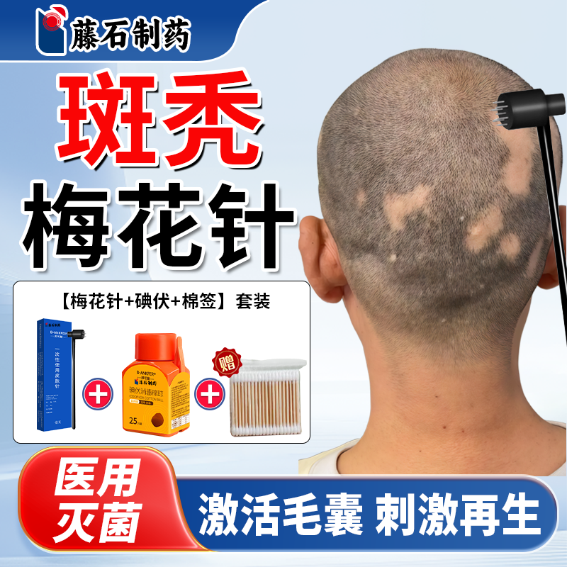 斑秃脱发中医用级放血七星梅花针锤敲头皮肤针一次性生发无痛QN