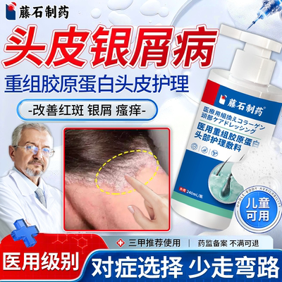 头皮牛皮癣银屑病洗发水