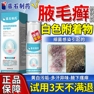 腋毛癣白色附着物腋窝去异味泥垢腋下藓搭清洗液喷雾剂膏药贴QN