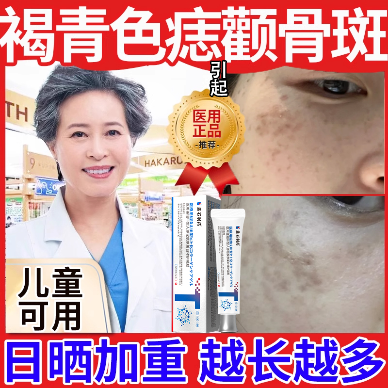 褐青色痣引起脸上斑点黄褐斑颧骨老年斑晒斑搭黑色素代谢斑点膏QN