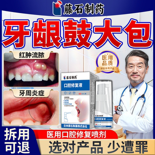 牙龈脓包搭肿痛消炎喷雾剂药水根尖周炎牙根发炎牙周炎牙龈上火QN