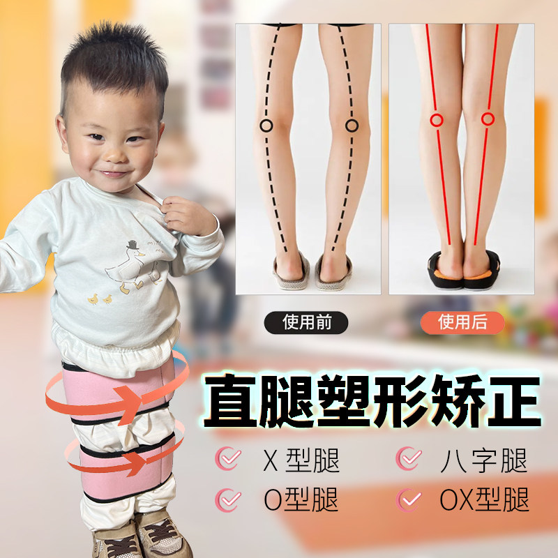 儿童婴儿o型腿x形腿矫正带宝宝腿外翻内八字脚非矫正器绑腿直腿带