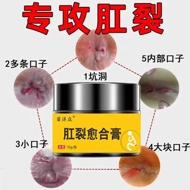 肛门裂特效愈合膏肛瘘肛周脓肿硬块肛裂大便出血肛门瘙痒封口软膏