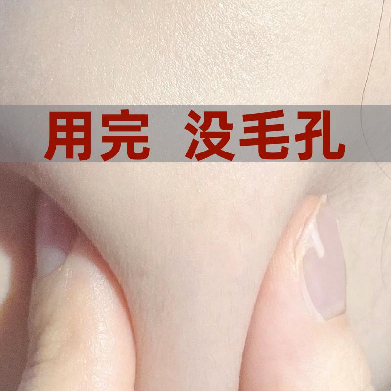 【赵露思推荐】排出脏东西 深层清洁脸部毛孔污垢~去脸部毛孔垃圾