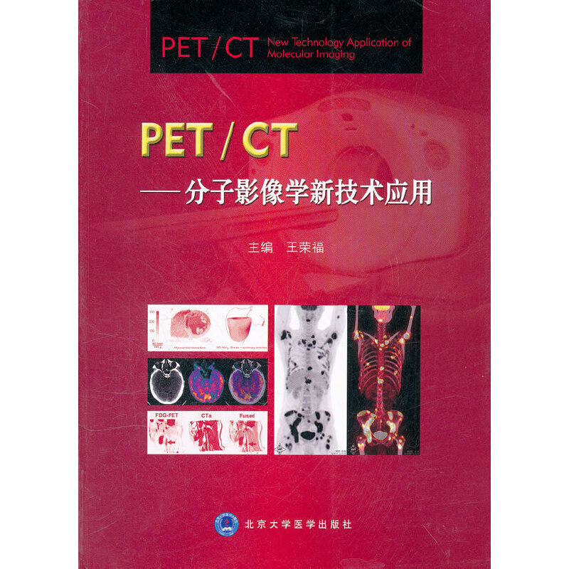 PET/CT:分子影像学新技术应用王荣福 主编9787565901997书籍\/杂志\/报纸/医学卫生/特种医学