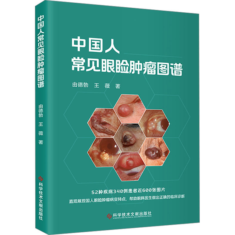 中国人常见眼睑肿瘤图谱由德勃,王薇 著9787523514283书籍\/杂志\/报纸/医学卫生/耳鼻喉科学