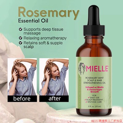 Hair Growth Essential Oil Rosemary Mint Hair Strengthening O