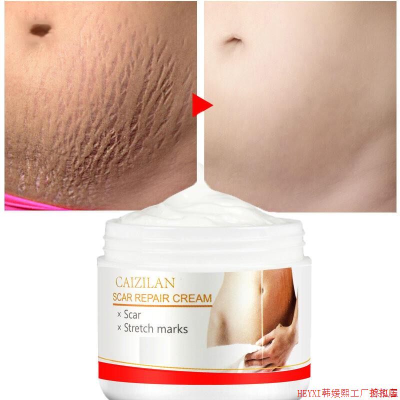Scar Repair Cre身体乳/霜