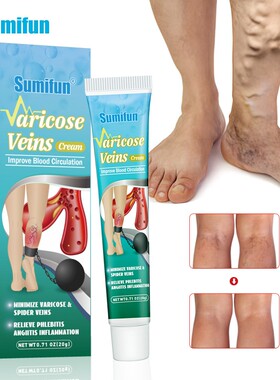 Varicose Veins Cream Patch Improve Blood Circulation