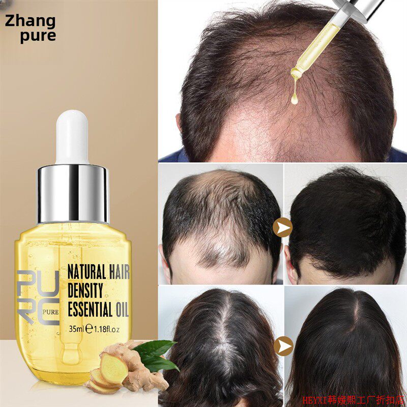 生姜头发生长产品预防脱发精油