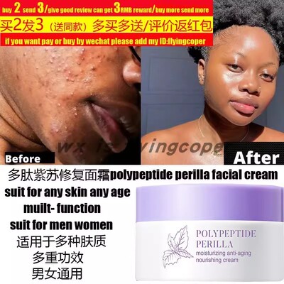 Turmeric Face Whitening Cream Dark Skin Acne spots african霜