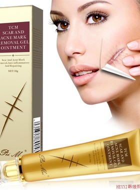 Acne Scar Removal Cream Pimples Stretch Marks Face Gel面霜乳