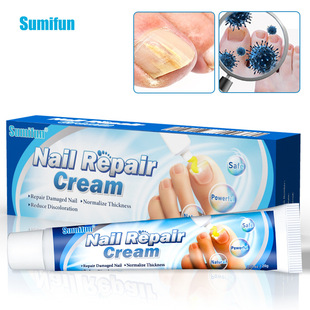 Sumifu 20g Nail Cream Whitenail Soft Nail Removal Ointment