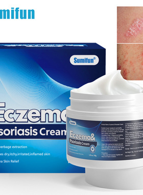 Sumifan ointment anti itch cream urea skincare cream skin n