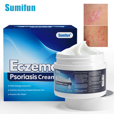 Sumifan ointment anti itch cream urea skincare cream skin n