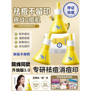 祛痘精华液淡化痘印去闭口粉刺改善泛红痘痘肌大灯泡祛痘精华