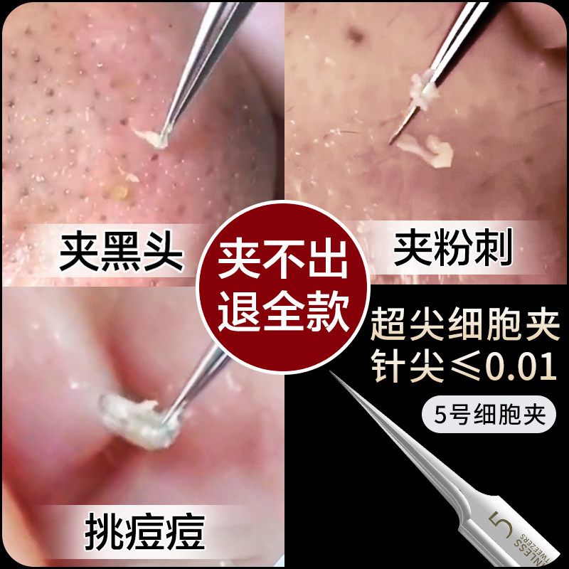 粉刺针细胞夹刮去黑头镊子超细排针闭口针一次性挑挤暗疮痘痘工具