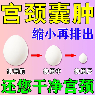 制霉菌素阴道软胶囊朗依硝呋太尔霉菌性阴道炎妇科用药硝夫栓软膏