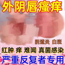阴道炎症凝胶敖东甲硝唑泡腾片妇科用药外阴瘙痒用止痒滴虫性感染