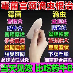 hpv干扰素a56b50万重组人工干扰素a2a栓剂2d栓塞抗