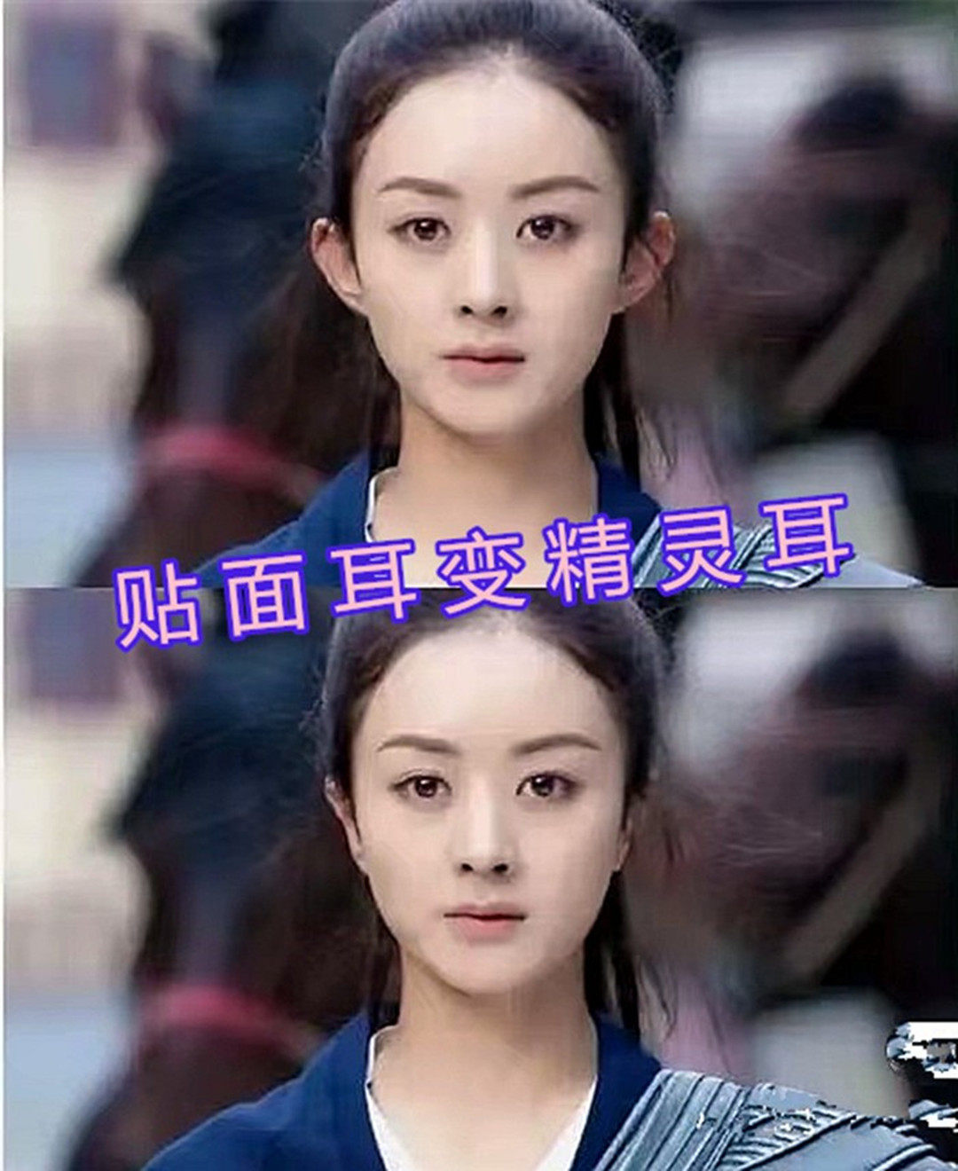 贴面耳神器矫正器贴面耳变招风耳精灵耳神器秒变招风耳贴耳撑定型