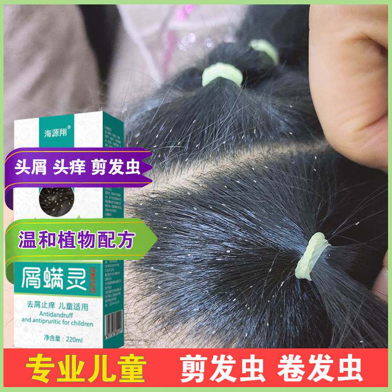 去剪发虫洗发水女孩专业除卷发虫吃发虫袪头屑止痒除螨儿童洗发露