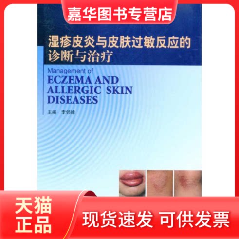 【正版现货】 湿疹皮炎与皮肤过敏反应的诊断与治疗 李邻峰 主编 北京大学医学出版社