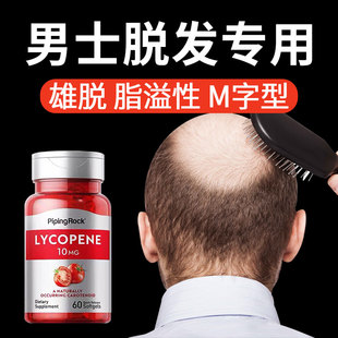 男士 非那雄胺片维生素严重防掉头发植物男专用食品营养 脱发专用