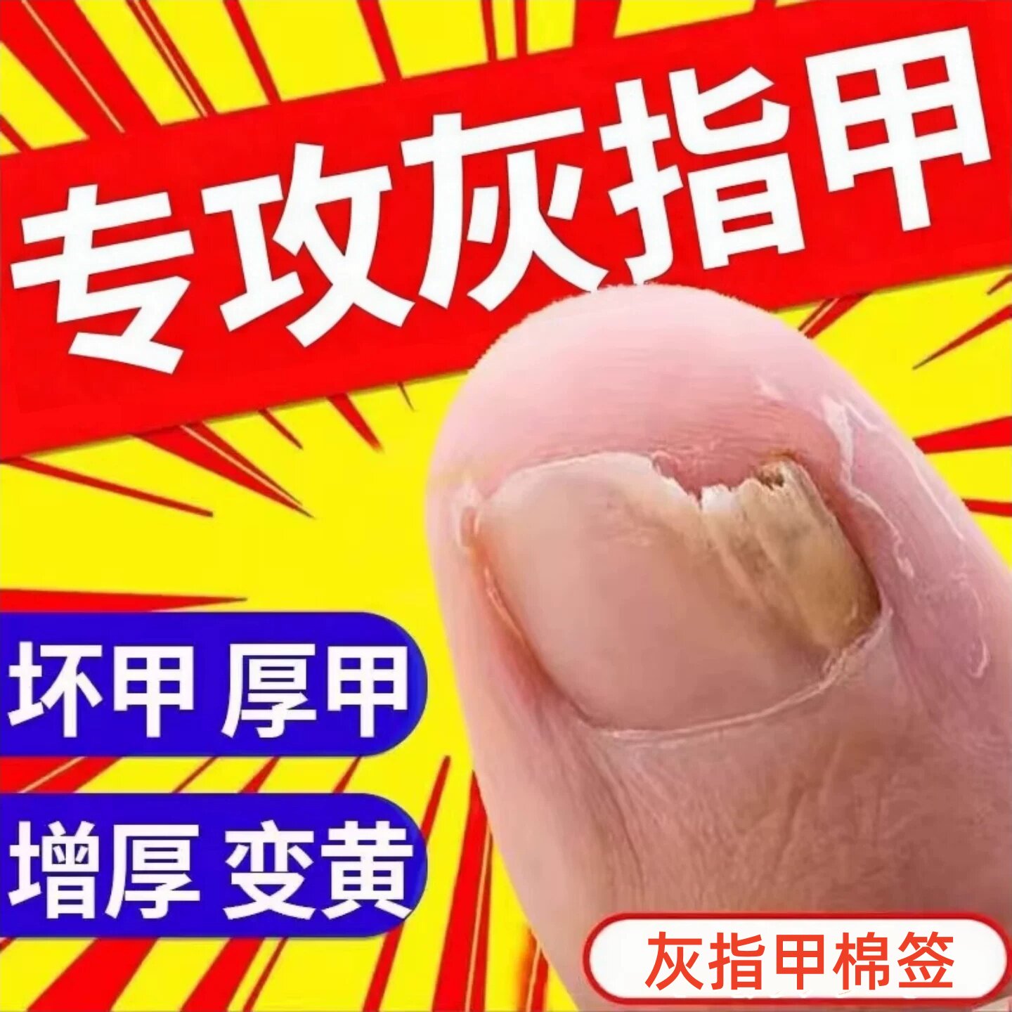 碘伏治灰指甲棉签棒抑菌液灰甲