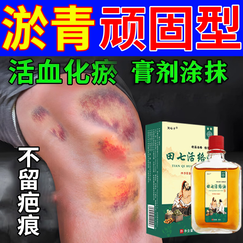 淤青快速消除儿童磕碰摔伤跌打损伤扭伤消肿止痛活血化瘀特效药水