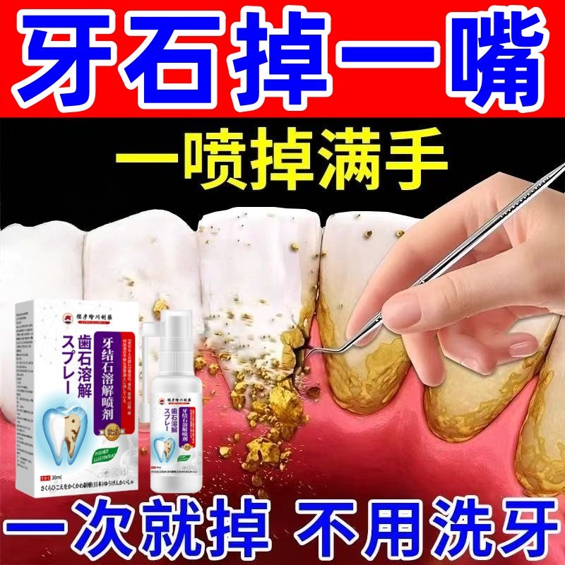 牙结石溶解喷雾医用口臭清理牙垢牙渍牙黄污垢速效去除神器漱口水,洗护清洁剂/卫生巾/纸/香薰,口腔护理套装/礼盒,淘宝优惠券,粉丝福利购,淘宝优惠卷