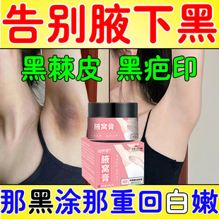 腋下美白去黑腋窝祛除黑色素沉淀咯吱窝膝盖手肘关节黑神器磨砂膏