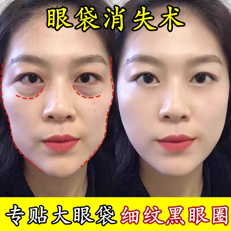【爆款好物】微晶眼膜淡化黑眼圈细纹大眼袋紧致抗皱提拉非小工具