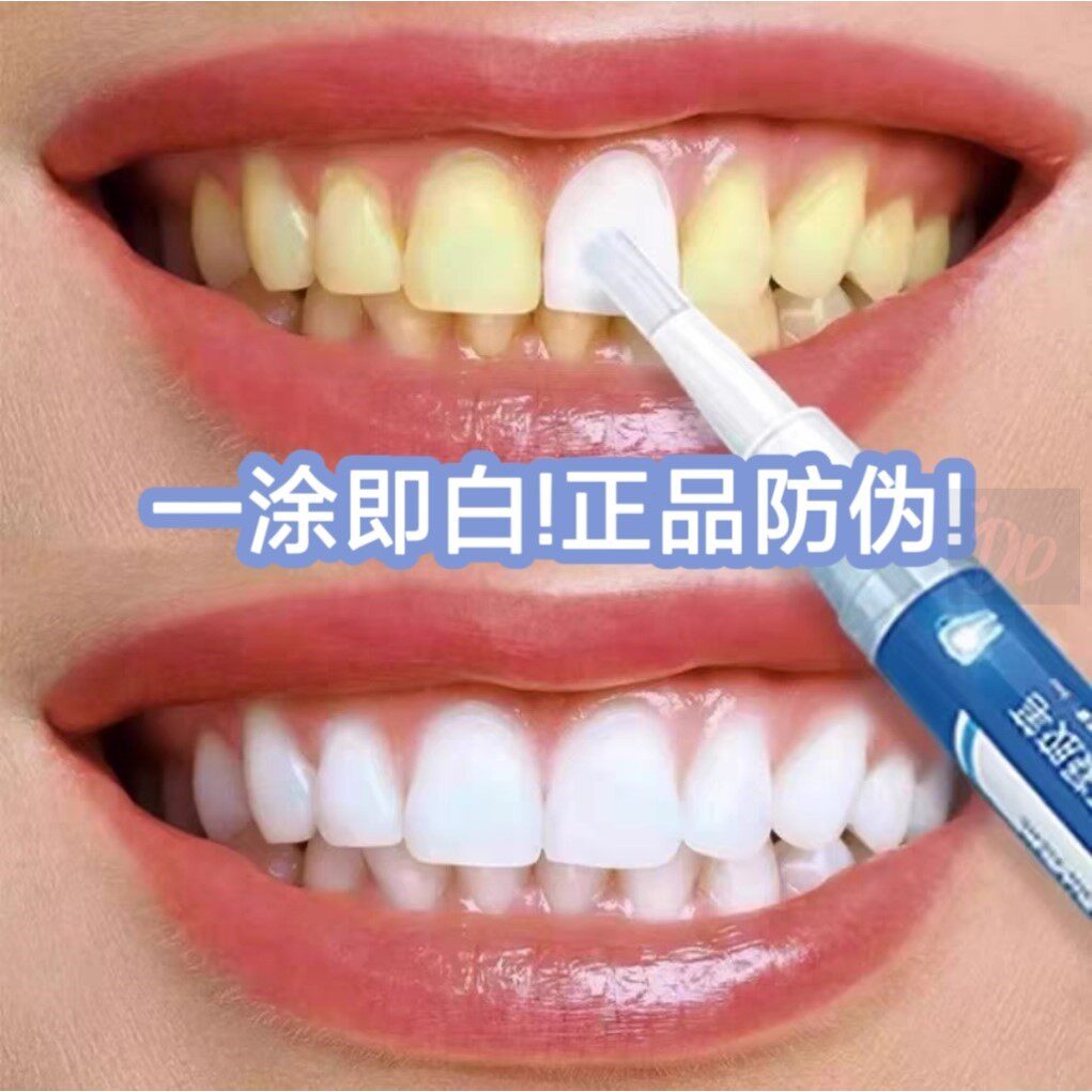 速效牙齿美白神器炫白洁牙笔去黄烟茶渍增白牙贴专克大黄牙咖喱笔